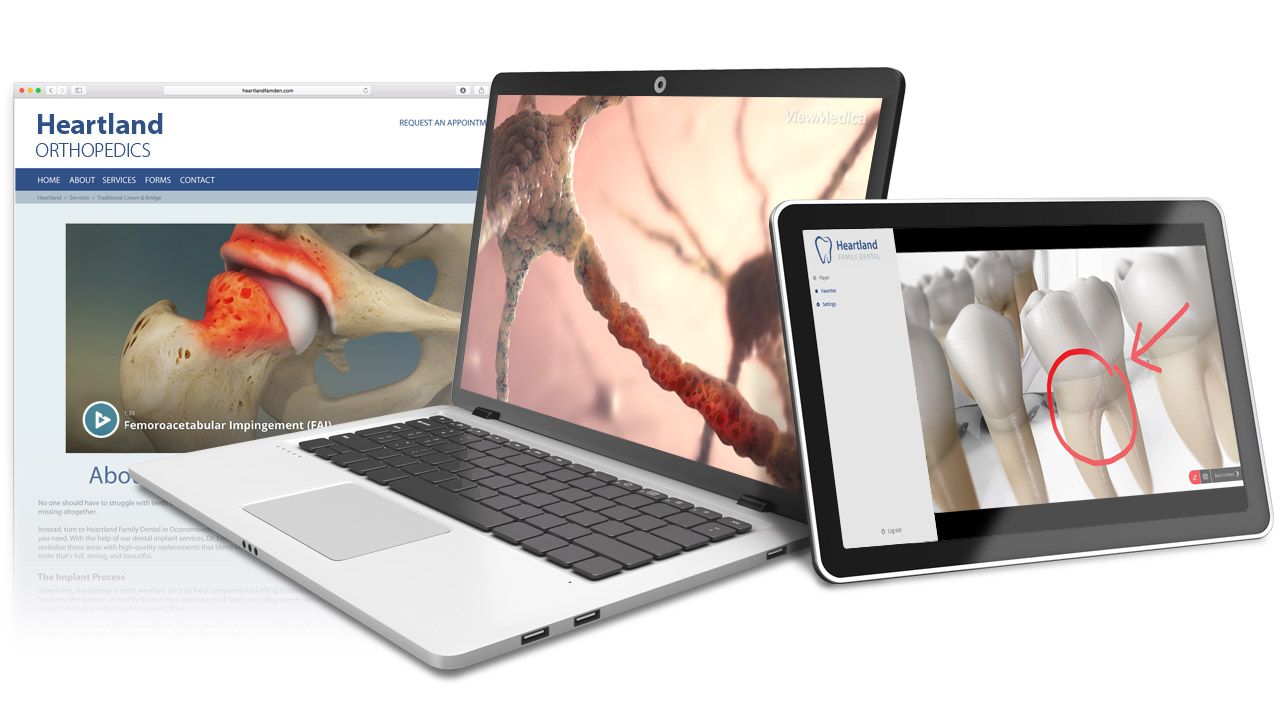 ViewMedica On-Demand brings patient education to your website and devices in your practice.
