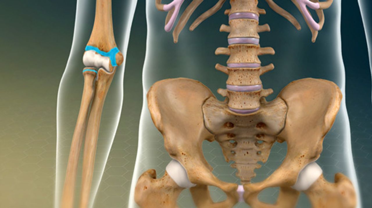 Orthopedics Library Thumbnail