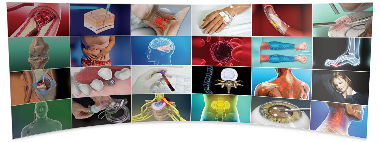 ViewMedica videos cover a wide variety of medical topics.